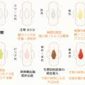 3日～1週間続く茶色いおりもの...かゆみ・臭い・性状からわかる原因と対処法