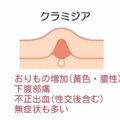 黄色いおりものが出る原因とは？ 色の変化からわかる体のサインと正しい対処法