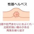 陰部に突然の痛みが走る…これって病気？