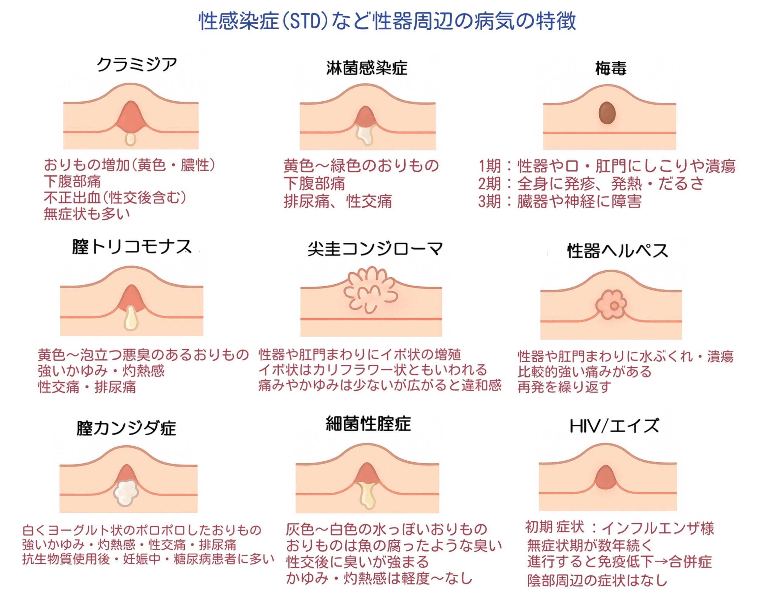 クラミジア感染症、淋菌感染症、梅毒、性器ヘルペス、尖圭コンジローマ、HIV/エイズ、膣トリコモナス症、細菌性腟症、膣カンジダ症