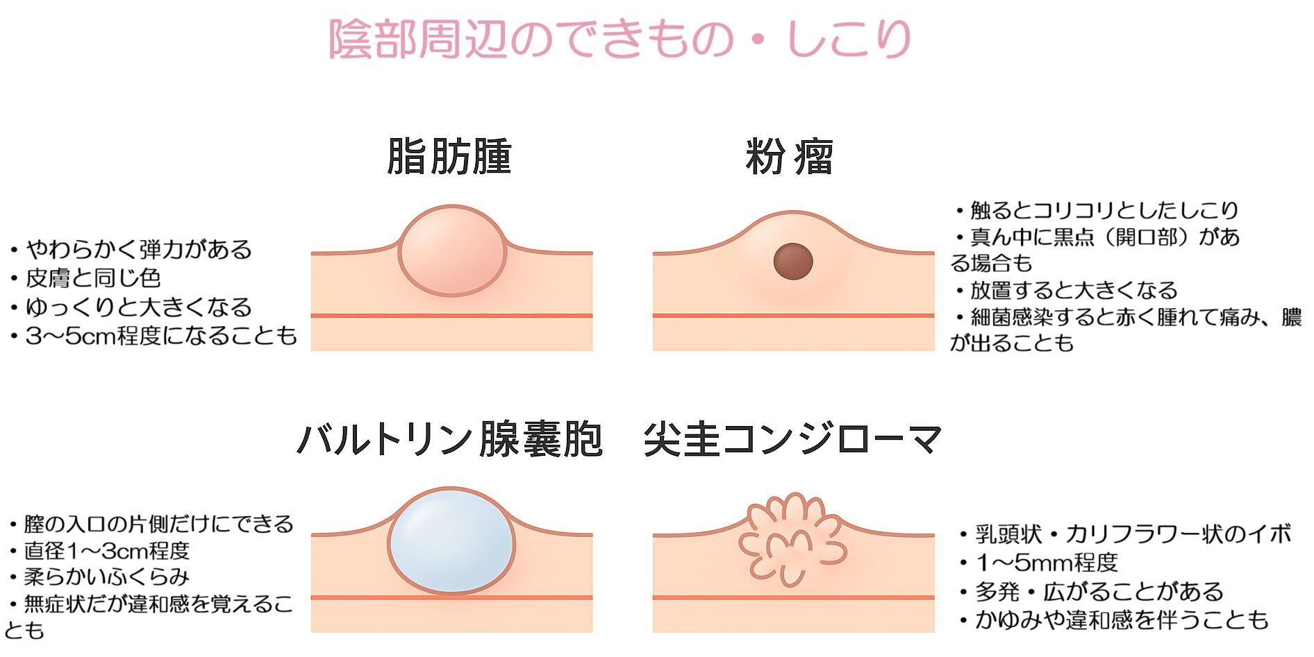 脂肪腫、紛瘤、バルトリン腺嚢胞、尖圭コンジローマ